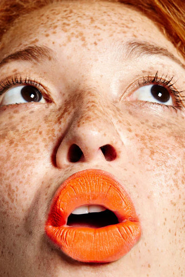 Freckle Fever: Why Sun-Kissed Spots Are Having a Moment
